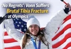 No Regrets: Vonn Suffers Brutal Tibia Fracture at Olympics